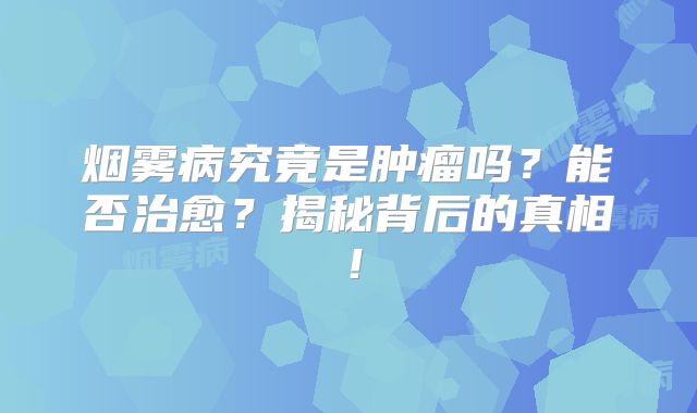 烟雾病究竟是肿瘤吗？能否治愈？揭秘背后的真相！