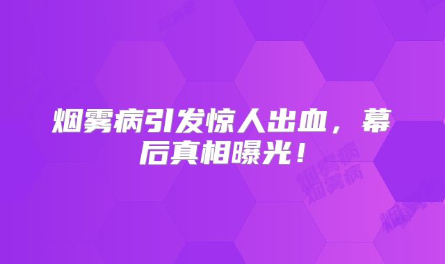烟雾病引发惊人出血，幕后真相曝光！