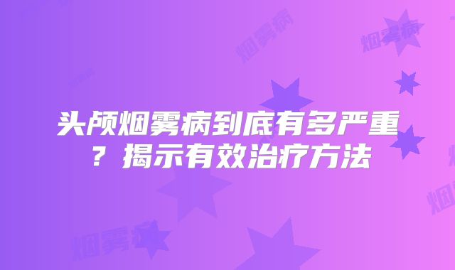头颅烟雾病到底有多严重？揭示有效治疗方法