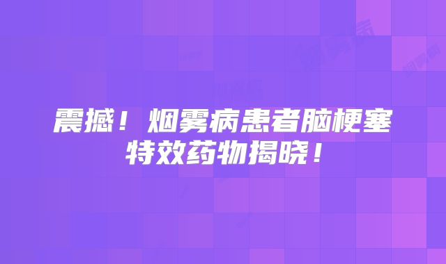 震撼！烟雾病患者脑梗塞特效药物揭晓！
