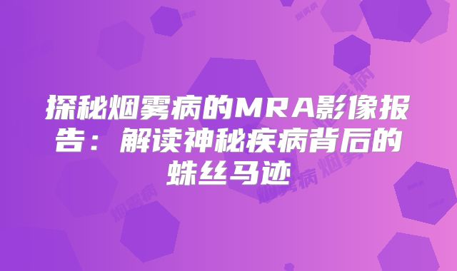 探秘烟雾病的MRA影像报告：解读神秘疾病背后的蛛丝马迹
