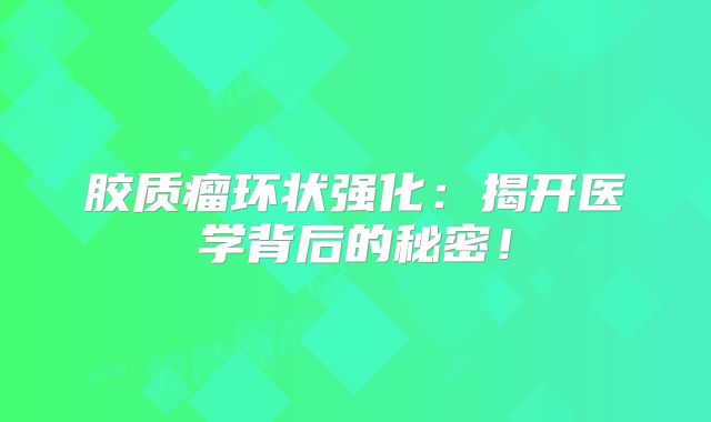 胶质瘤环状强化：揭开医学背后的秘密！
