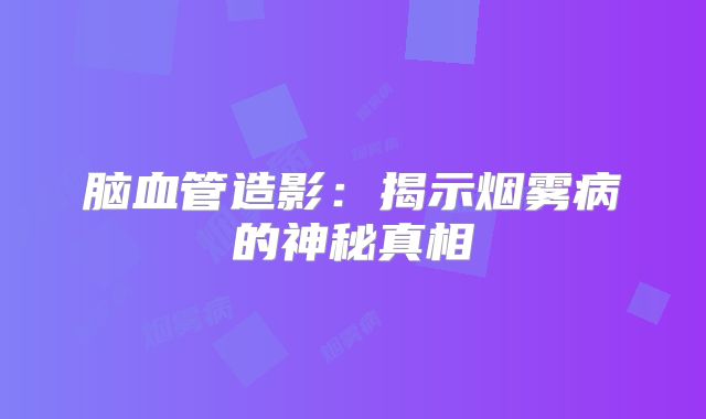 脑血管造影：揭示烟雾病的神秘真相