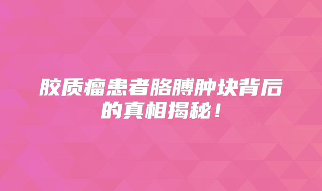 胶质瘤患者胳膊肿块背后的真相揭秘！