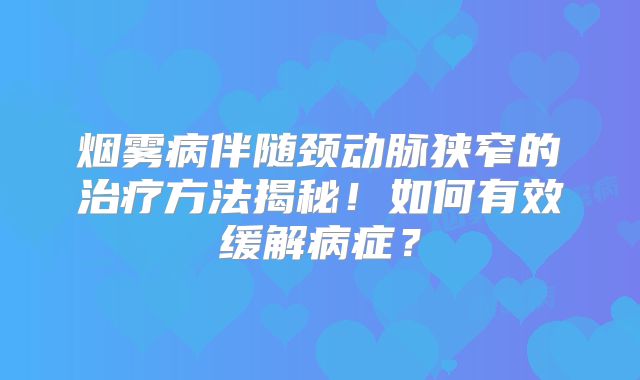 烟雾病伴随颈动脉狭窄的治疗方法揭秘！如何有效缓解病症？