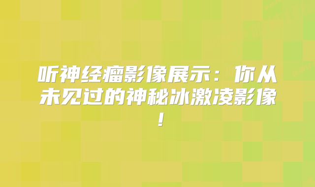 听神经瘤影像展示：你从未见过的神秘冰激凌影像！