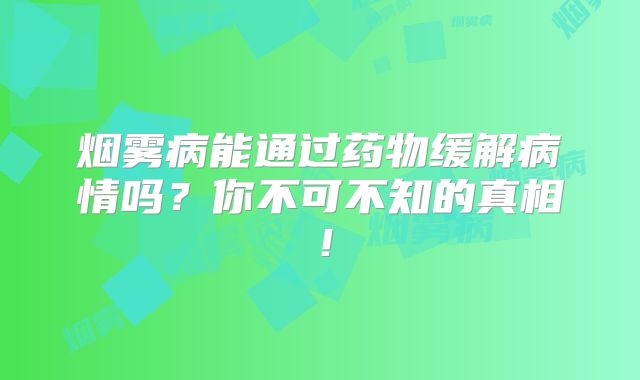 烟雾病能通过药物缓解病情吗？你不可不知的真相！