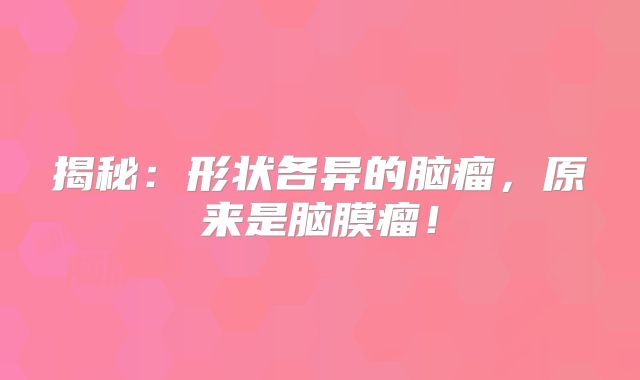 揭秘：形状各异的脑瘤，原来是脑膜瘤！