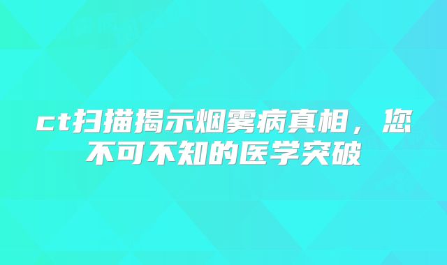 ct扫描揭示烟雾病真相，您不可不知的医学突破