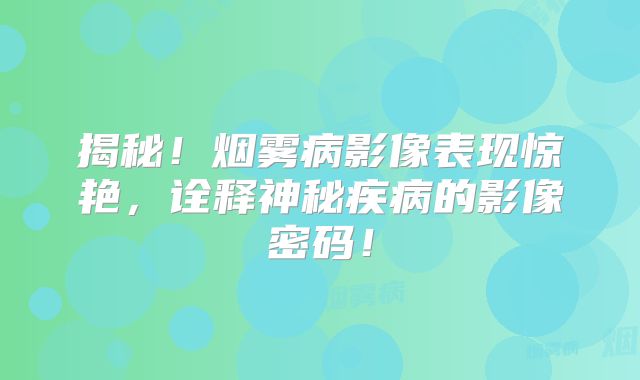 揭秘！烟雾病影像表现惊艳，诠释神秘疾病的影像密码！
