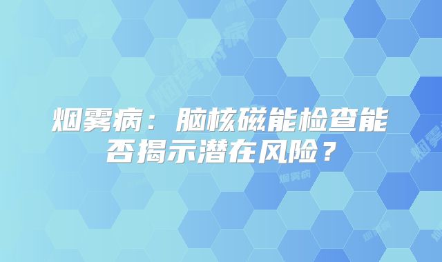 烟雾病：脑核磁能检查能否揭示潜在风险？