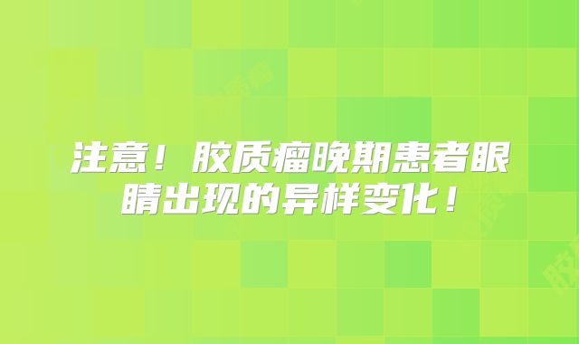 注意！胶质瘤晚期患者眼睛出现的异样变化！