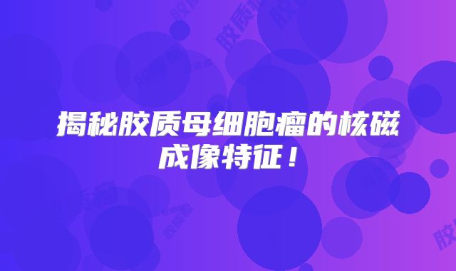 揭秘胶质母细胞瘤的核磁成像特征！
