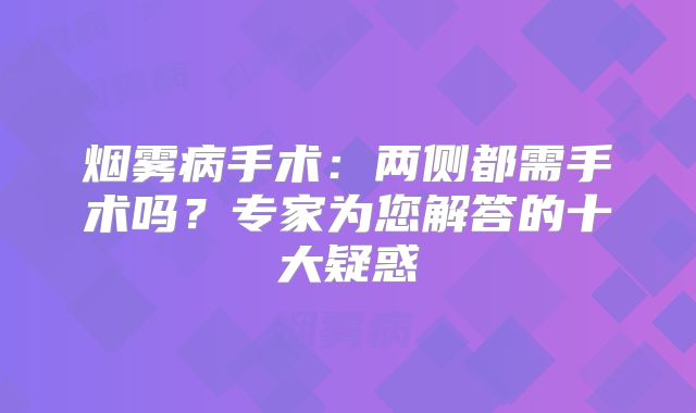 烟雾病手术：两侧都需手术吗？专家为您解答的十大疑惑