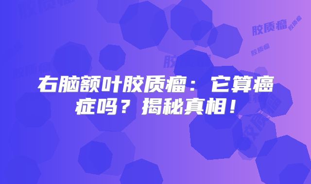 右脑额叶胶质瘤：它算癌症吗？揭秘真相！