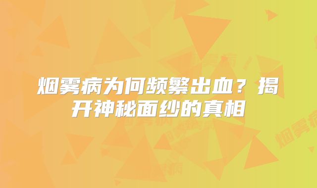 烟雾病为何频繁出血？揭开神秘面纱的真相
