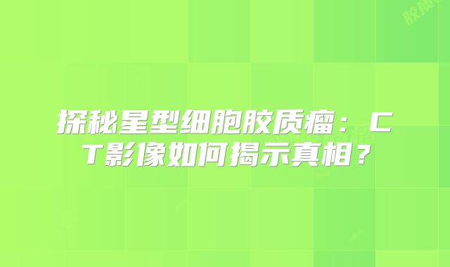 探秘星型细胞胶质瘤：CT影像如何揭示真相？