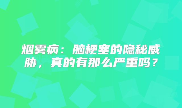 烟雾病：脑梗塞的隐秘威胁，真的有那么严重吗？