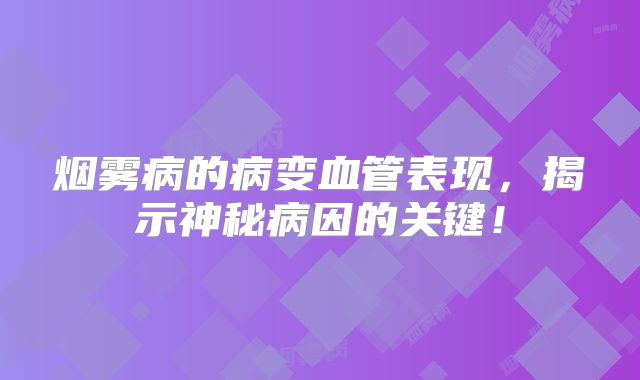 烟雾病的病变血管表现，揭示神秘病因的关键！