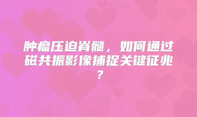 肿瘤压迫脊髓，如何通过磁共振影像捕捉关键征兆？