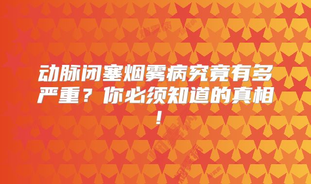 动脉闭塞烟雾病究竟有多严重？你必须知道的真相！