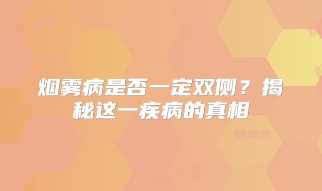 烟雾病是否一定双侧？揭秘这一疾病的真相