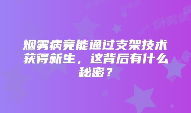 烟雾病竟能通过支架技术获得新生，这背后有什么秘密？