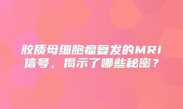 胶质母细胞瘤复发的MRI信号，揭示了哪些秘密？