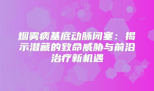 烟雾病基底动脉闭塞：揭示潜藏的致命威胁与前沿治疗新机遇