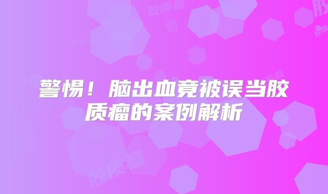 警惕！脑出血竟被误当胶质瘤的案例解析