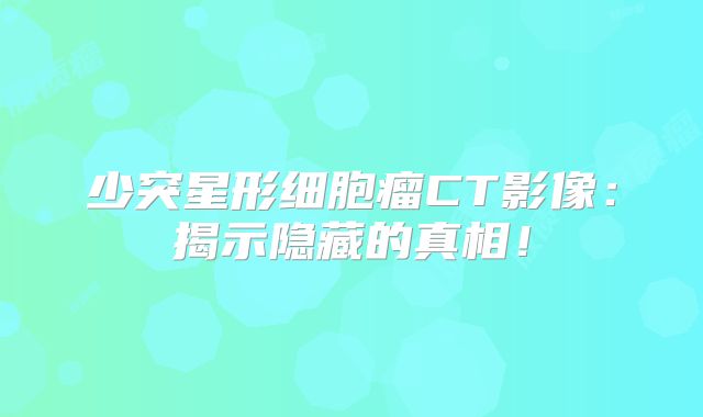 少突星形细胞瘤CT影像：揭示隐藏的真相！