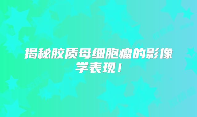 揭秘胶质母细胞瘤的影像学表现！