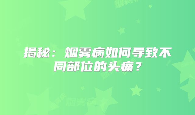 揭秘：烟雾病如何导致不同部位的头痛？
