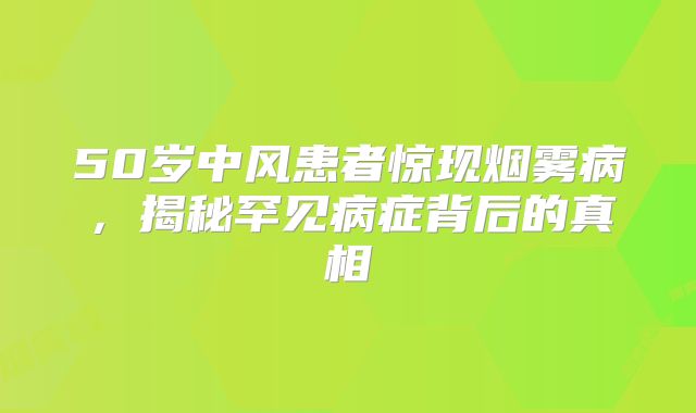 50岁中风患者惊现烟雾病，揭秘罕见病症背后的真相