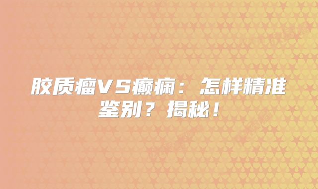胶质瘤VS癫痫：怎样精准鉴别？揭秘！