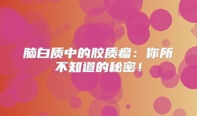 脑白质中的胶质瘤：你所不知道的秘密！
