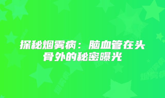探秘烟雾病：脑血管在头骨外的秘密曝光