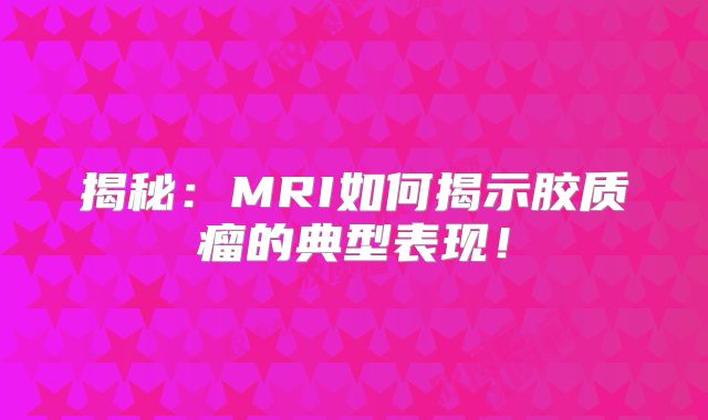 揭秘：MRI如何揭示胶质瘤的典型表现！
