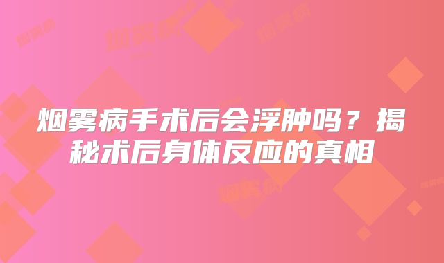 烟雾病手术后会浮肿吗？揭秘术后身体反应的真相