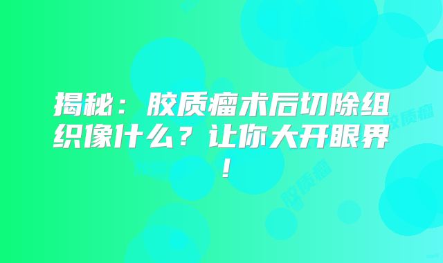 揭秘：胶质瘤术后切除组织像什么？让你大开眼界！