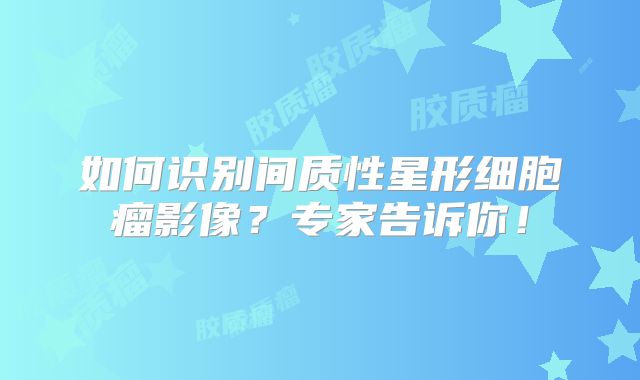 如何识别间质性星形细胞瘤影像？专家告诉你！