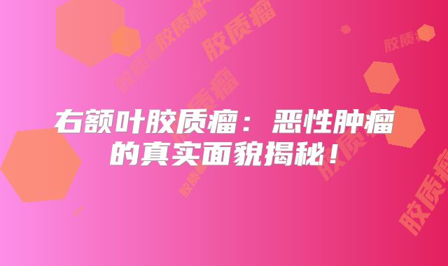 右额叶胶质瘤：恶性肿瘤的真实面貌揭秘！