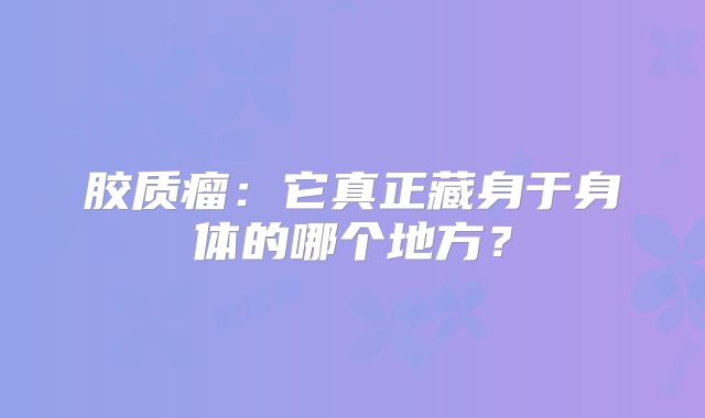 胶质瘤：它真正藏身于身体的哪个地方？