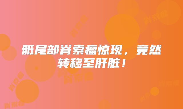 骶尾部脊索瘤惊现，竟然转移至肝脏！