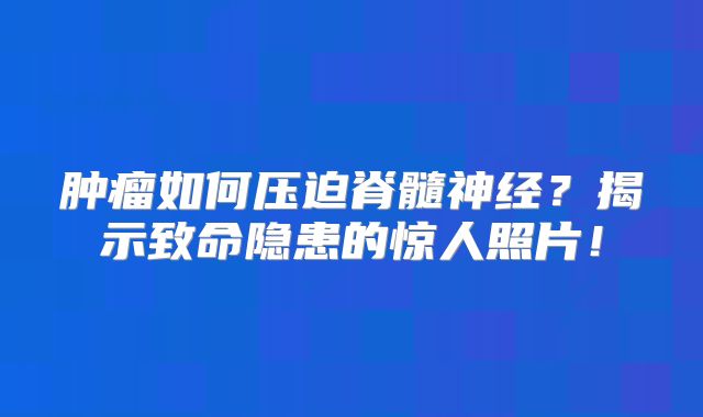 肿瘤如何压迫脊髓神经？揭示致命隐患的惊人照片！