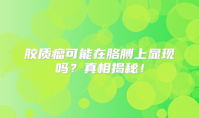胶质瘤可能在胳膊上显现吗？真相揭秘！