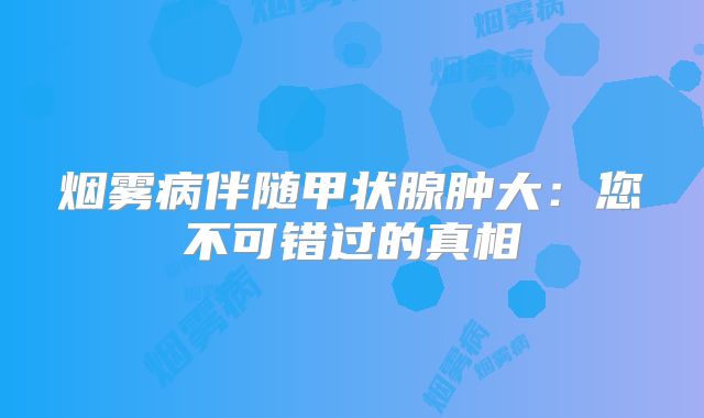 烟雾病伴随甲状腺肿大：您不可错过的真相