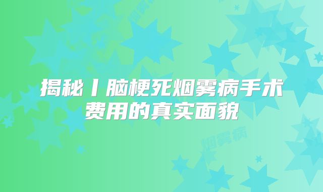 揭秘丨脑梗死烟雾病手术费用的真实面貌