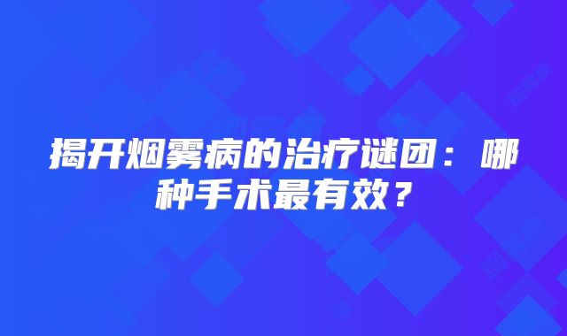 揭开烟雾病的治疗谜团：哪种手术最有效？