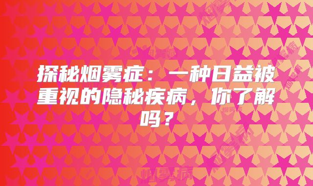 探秘烟雾症：一种日益被重视的隐秘疾病，你了解吗？